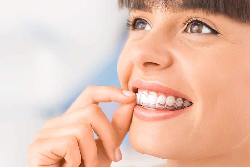 Clear Aligner Treatment in Gilbert and Queen Creek